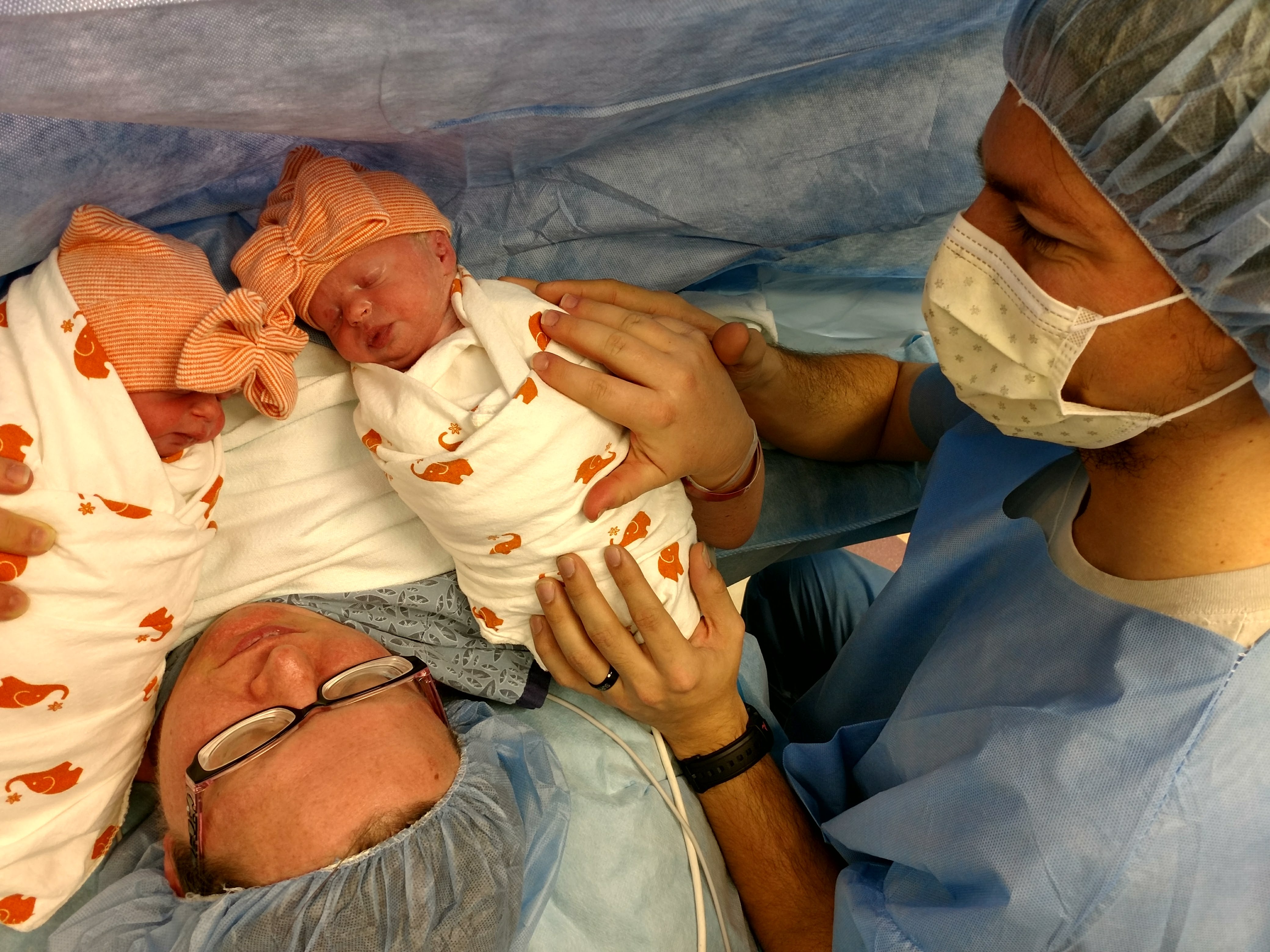 The Twins a few minutes old